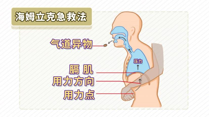 误吃东西急救方法,吃东西时别说话幼儿安全教育