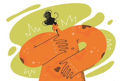 全身湿疹半年了反反复复,湿疹吃药半年了就是不好