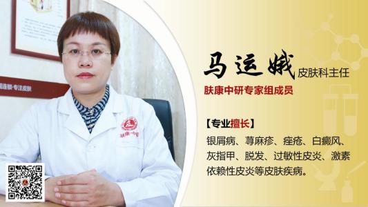 斑秃是什么原因造成的如何治疗,济南斑秃能治疗好吗