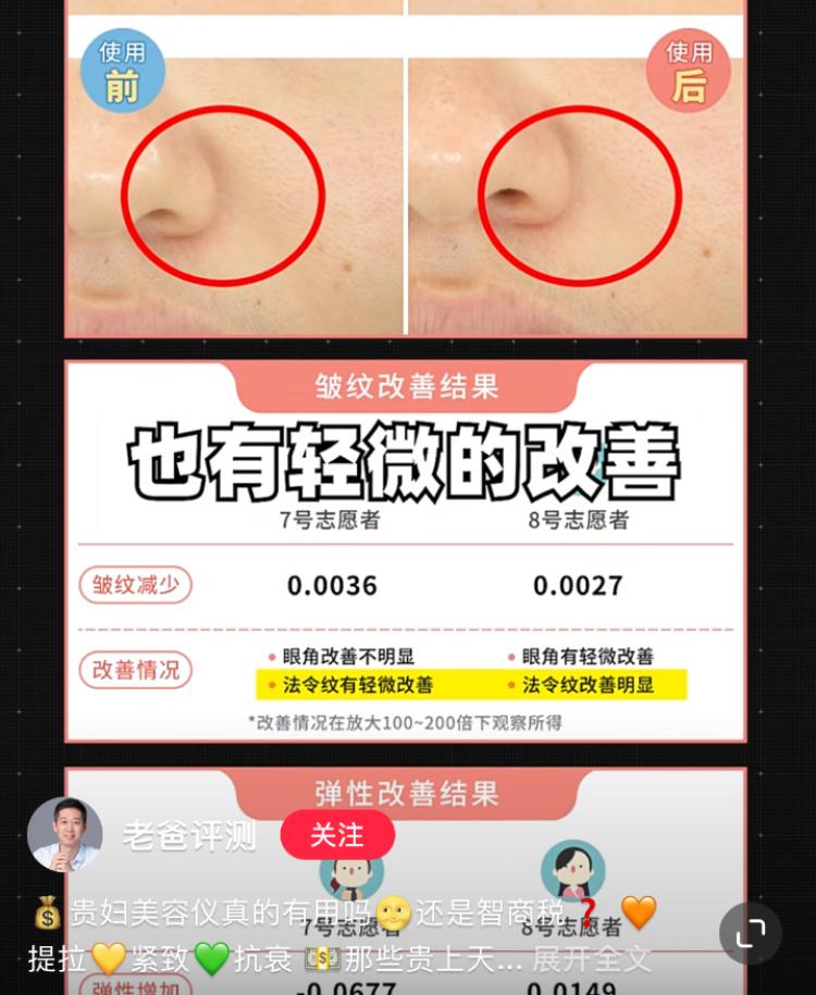 700块钱的美容仪是智商税吗,美容仪是智商税还是真的有用