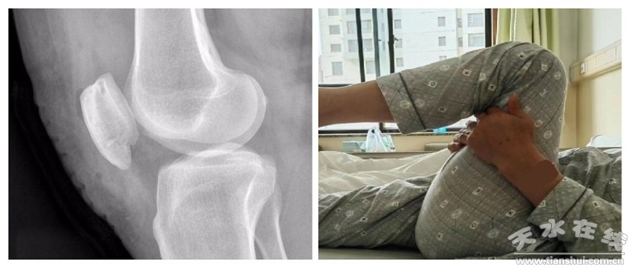 天水一院,天水市市一院